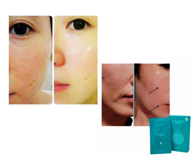 Nu Skin Ultimate Waterfull Mask review photo by Valmendoza