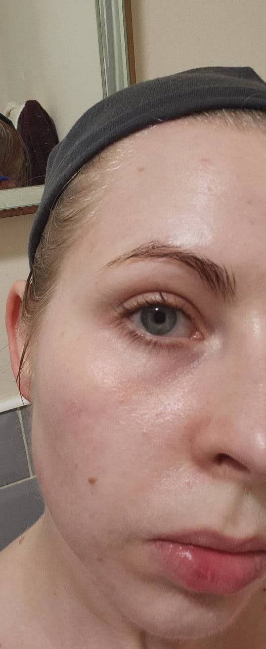 SkinChemists Youth Series 1.5% Hyaluronic Acid Eye Serum review photo by MizuUnni