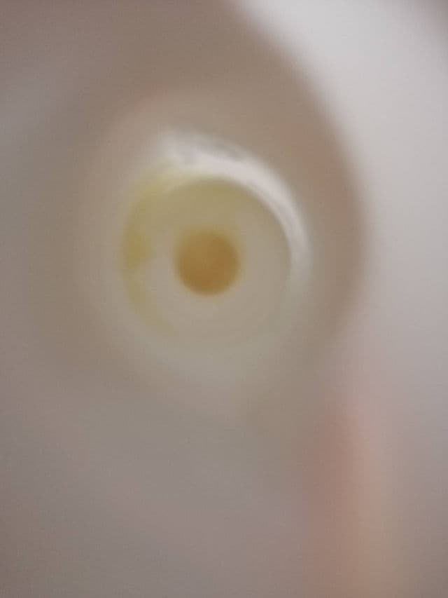 Eucerin Pro Acne A.I Clearing Treatment review photo by PYuu