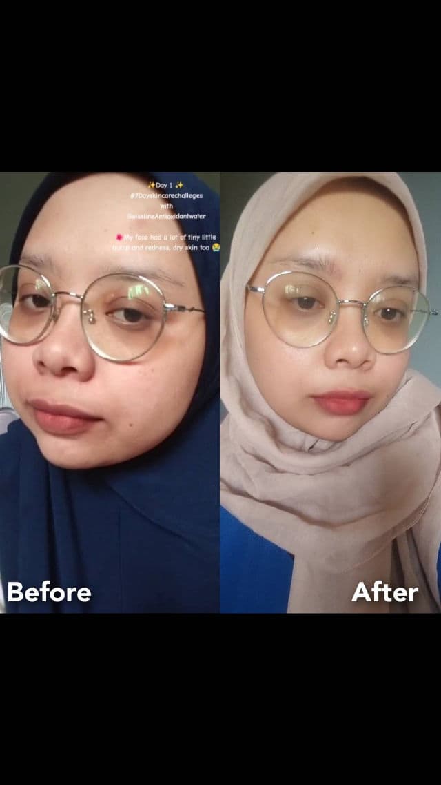 Kose Sekkisei Clear Wellness Pure Conc review photo by pickydaughter