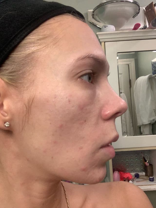 INNBeauty Project Refine AHA+BHA Texture & Pore Serum review photo by ReneeEgan