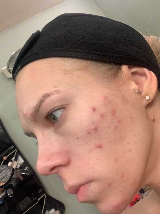 INNBeauty Project Refine AHA+BHA Texture & Pore Serum review photo by ReneeEgan