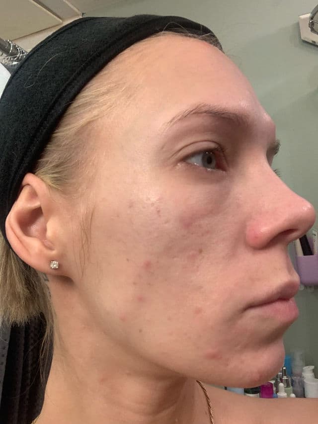 INNBeauty Project Refine AHA+BHA Texture & Pore Serum review photo by ReneeEgan