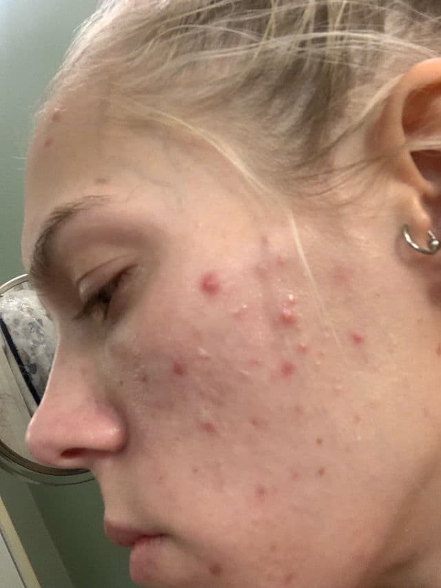 INNBeauty Project Refine AHA+BHA Texture & Pore Serum review photo by ReneeEgan