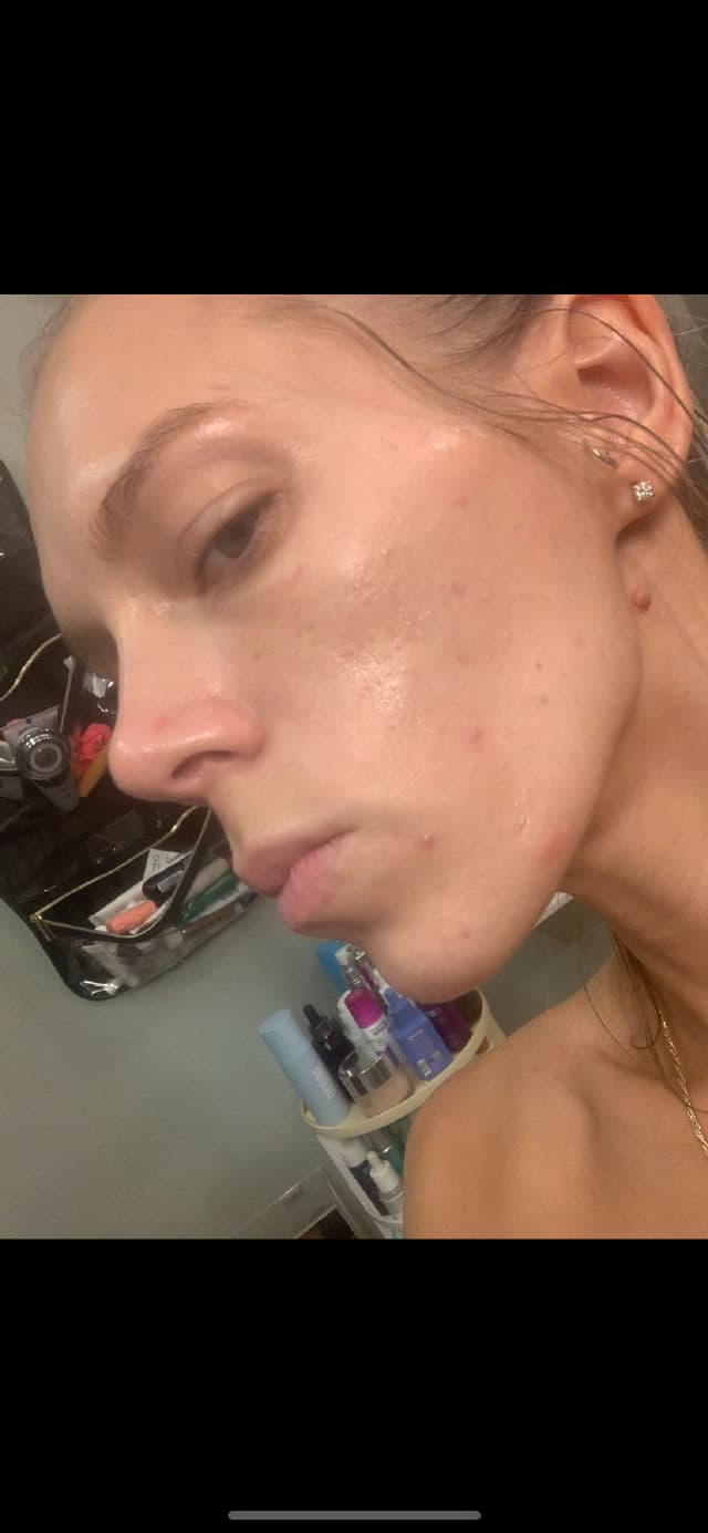 INNBeauty Project Refine AHA+BHA Texture & Pore Serum review photo by ReneeEgan