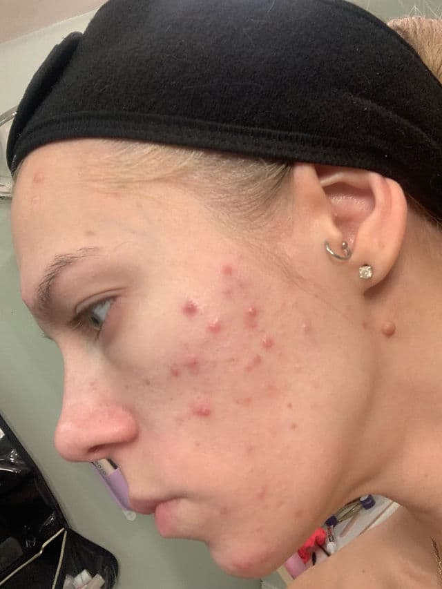 INNBeauty Project Refine AHA+BHA Texture & Pore Serum review photo by ReneeEgan