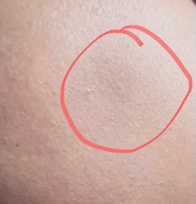 Mesoestetic Brightening Peel Booster  review photo by Fatz14