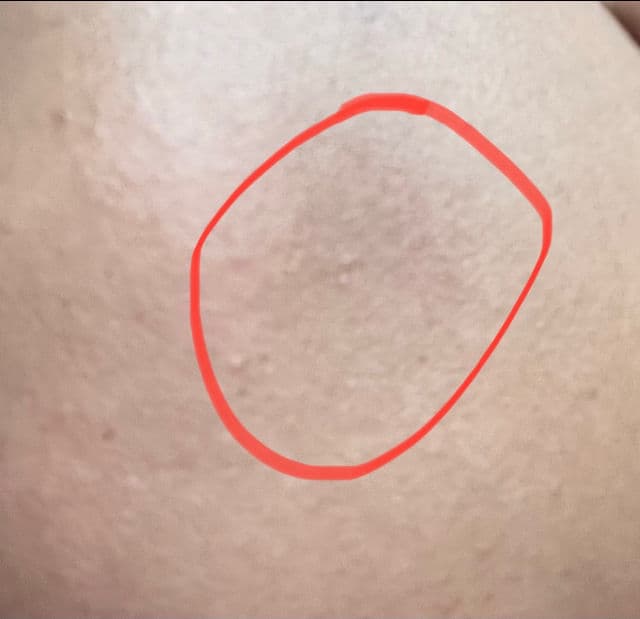 Mesoestetic Brightening Peel Booster  review photo by Fatz14