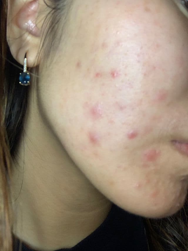 Abib Jericho Rose Bifida Serum Firming Drop review photo by luvvskinj