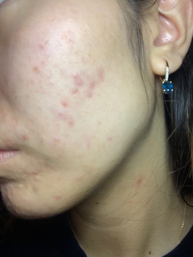 Abib Jericho Rose Bifida Serum Firming Drop review photo by luvvskinj