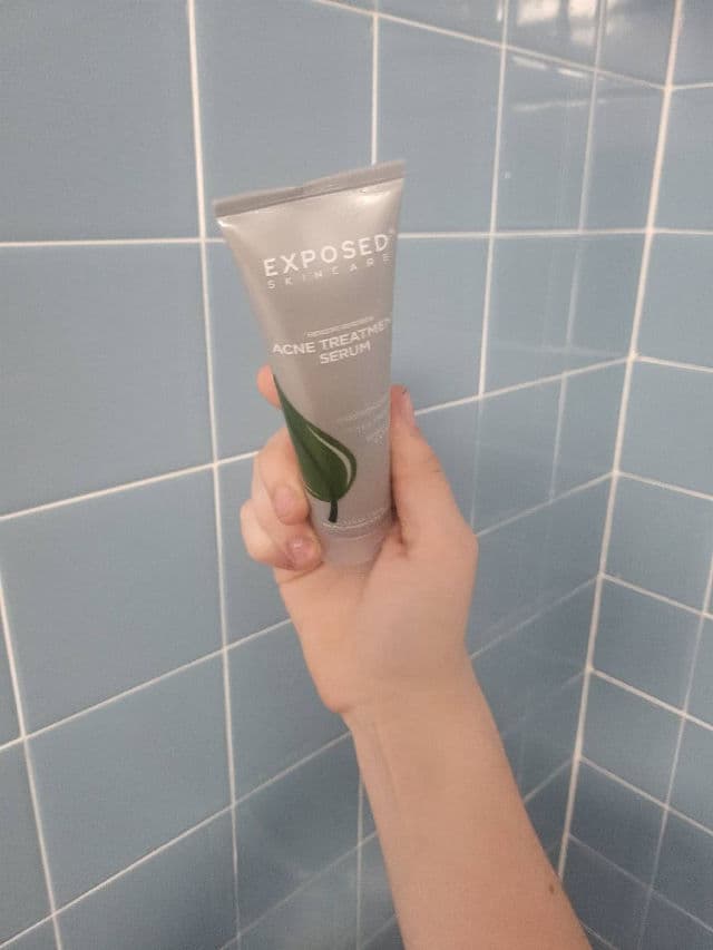 Exposed Skin Care Acne Treatment Serum review photo by Char00