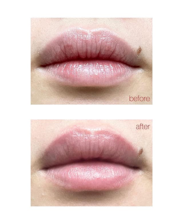 Ever Bilena Plus+ Lip Must Lip Mask review photo by AndreaKane