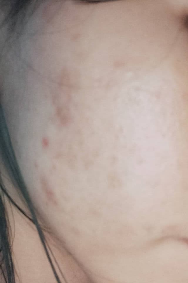 Azarine Calm My Acne Sunscreen Moisturiser SPF35 PA+++ review photo by ChuyXxs