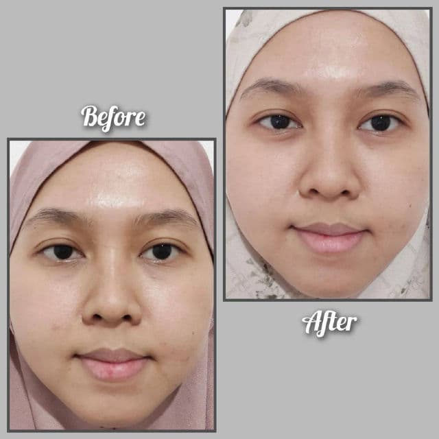 Innertrue Focus Vitamin C 10% + Peptide 1% Ampoule review photo by Ghina