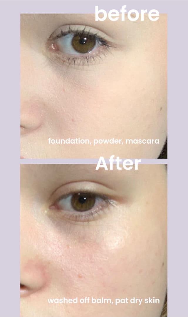 Clinique Take The Day Off Cleansing Balm review photo by bunnycake