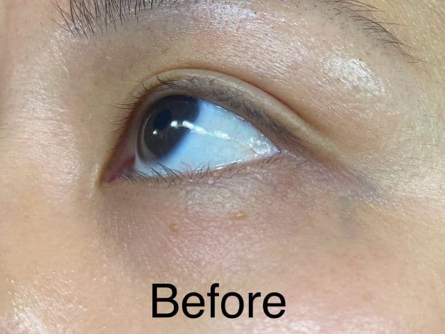 Shiseido Benefiance Wrinkle Smoothing Eye Cream review photo by andthenjen