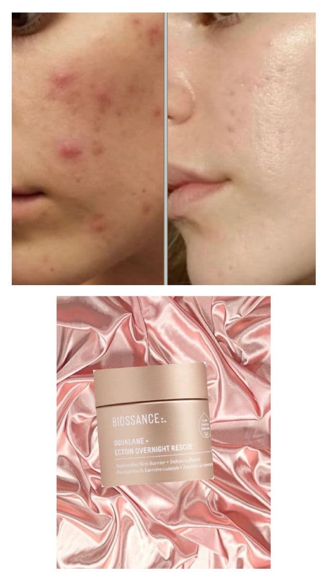 Biossance Squalane + Ectoin Overnight Rescue review photo by Pickycarrie