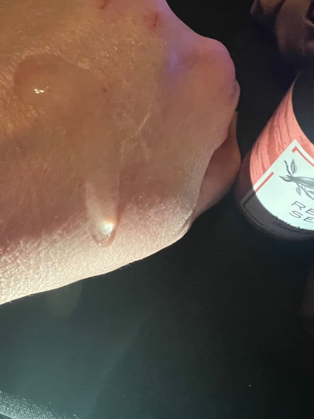 Eclat Skin London Retinol Serum review photo by lynnc355