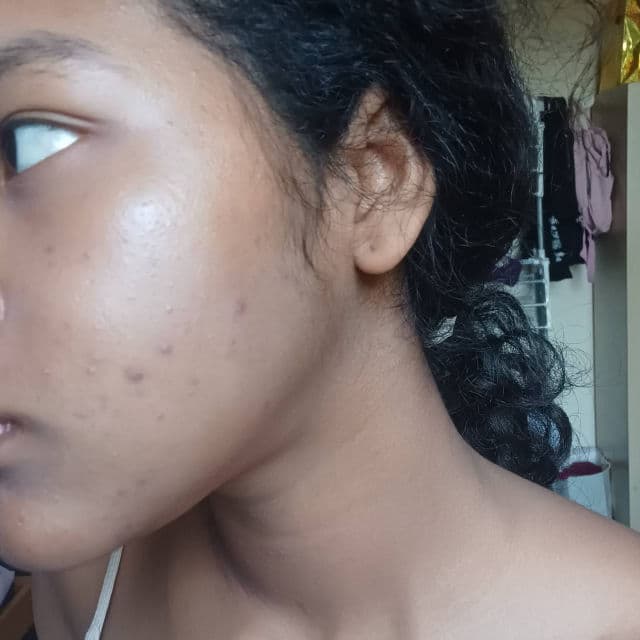 Some By Mi AHA BHA PHA 30 Days Miracle Toner review photo by maayland