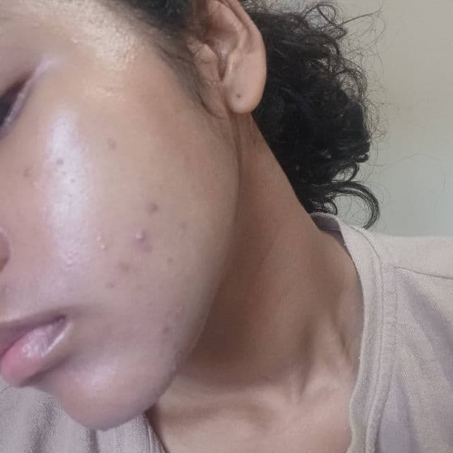 Some By Mi AHA BHA PHA 30 Days Miracle Cream review photo by maayland