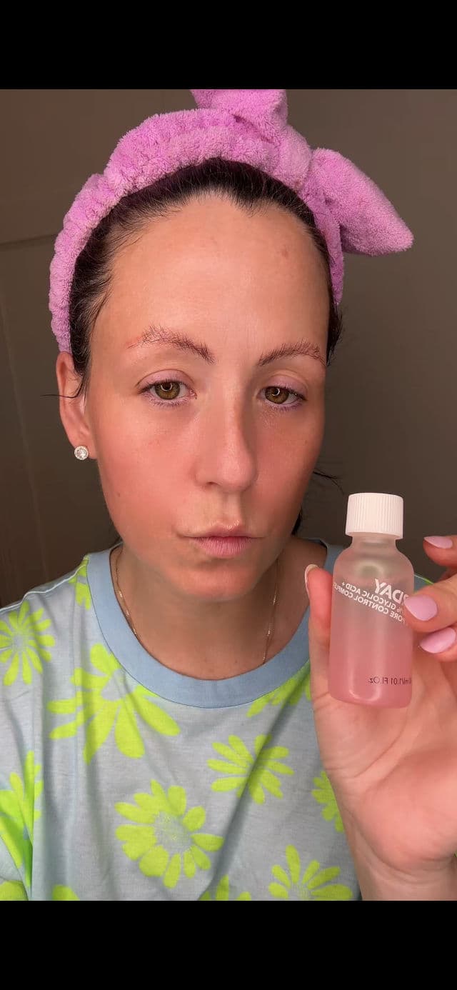 Saturday Skin Pore Clarifying Toner 10% Glycolic Acid + Pore Control Complex review photo by Justmeebonibreeugc