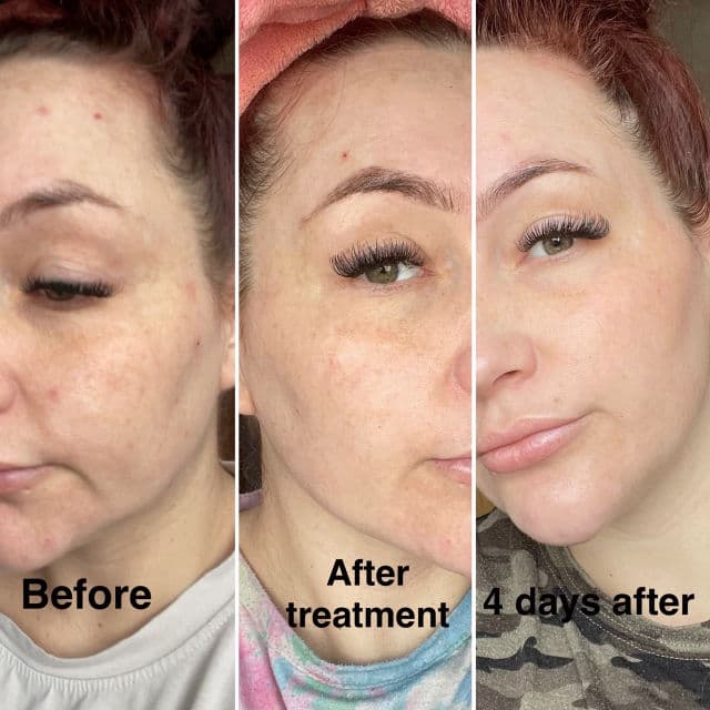 Decree Skincare Dr. AJ Sturnham SOS Revitalising Sheet Mask review photo by meme27886