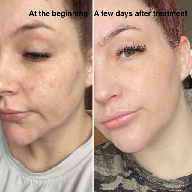 Decree Skincare Dr. AJ Sturnham SOS Revitalising Sheet Mask review photo by meme27886