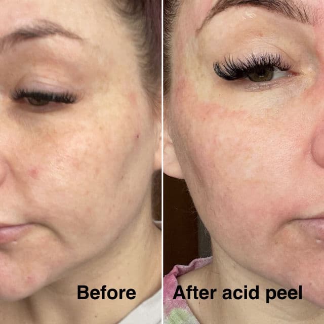 Decree Skincare Dr. AJ Sturnham SOS Revitalising Sheet Mask review photo by meme27886