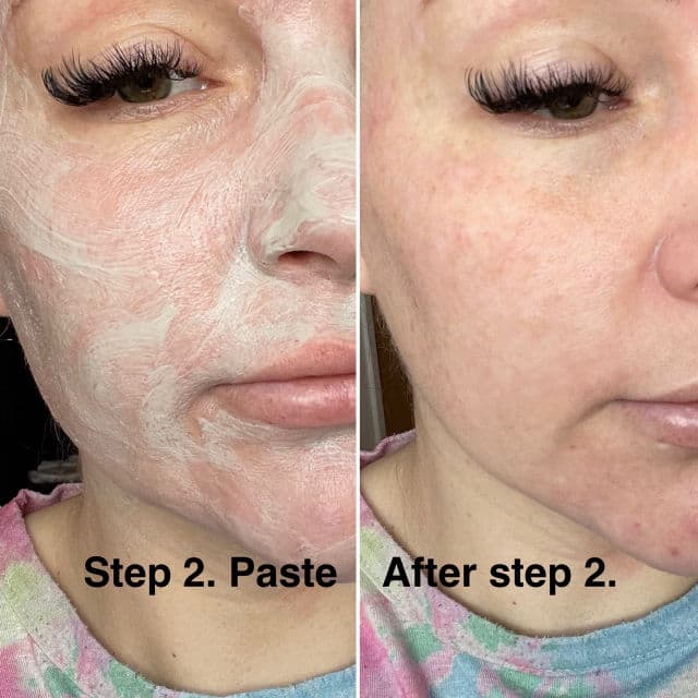 Decree Skincare Dr. AJ Sturnham SOS Revitalising Sheet Mask review photo by meme27886