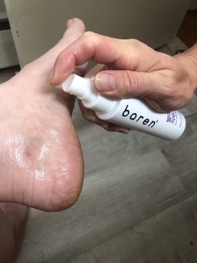 Baren Callus Remover Kit for Feet: Foot File & Peeling Foot Spray review photo by Esther0316