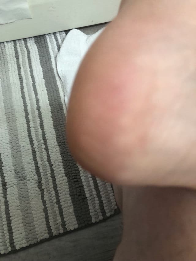 Baren Callus Remover Kit for Feet: Foot File & Peeling Foot Spray review photo by Esther0316