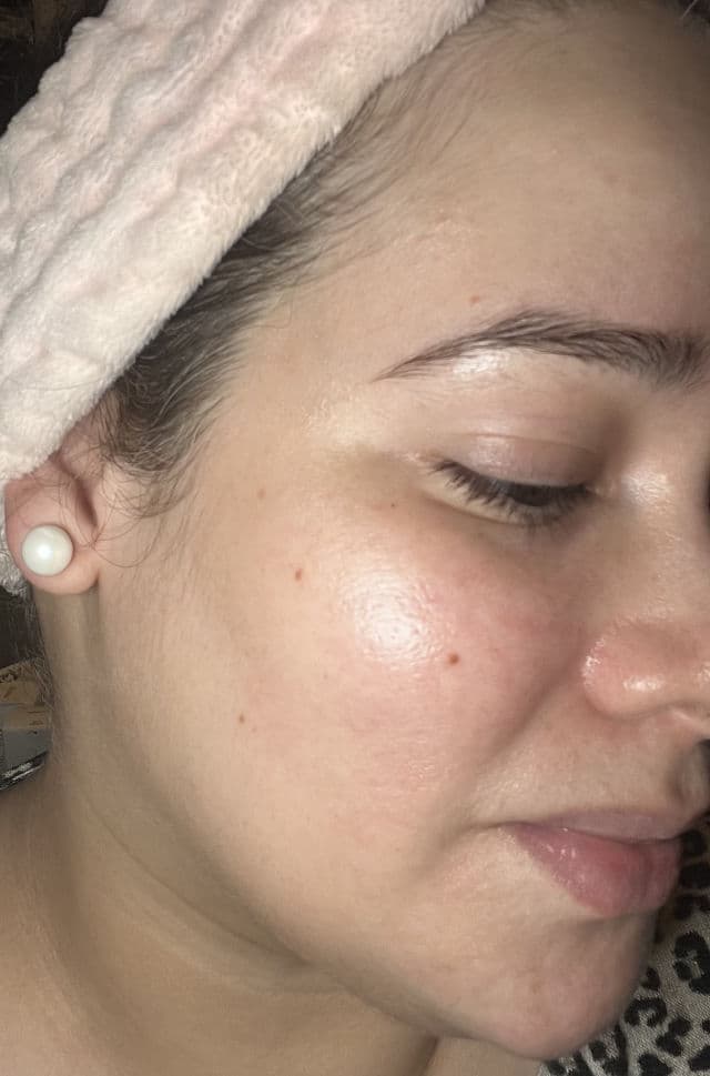 ANUA Niacinamide 10% + TXA 4% Dark Spot Correcting Serum review photo by bonanza