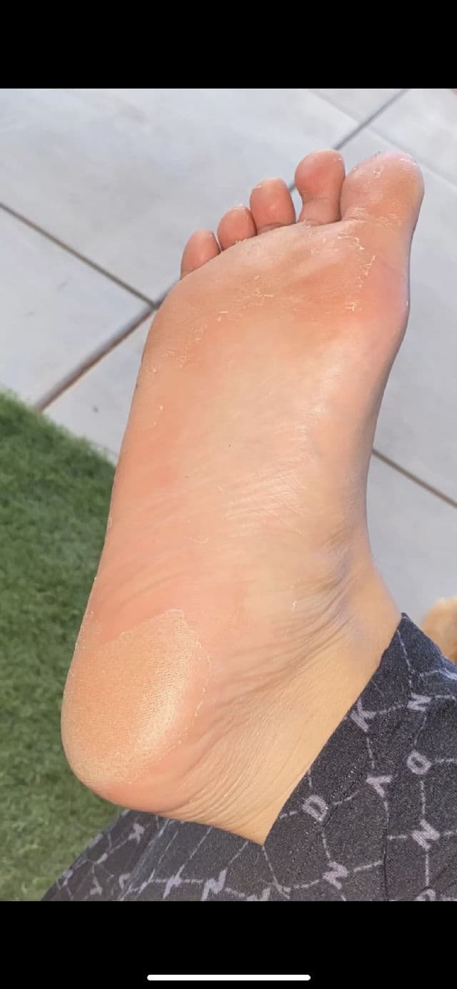 Masque Bar Gentle Exfoliating Foot Mask review photo by CindyCuidaTuPiel