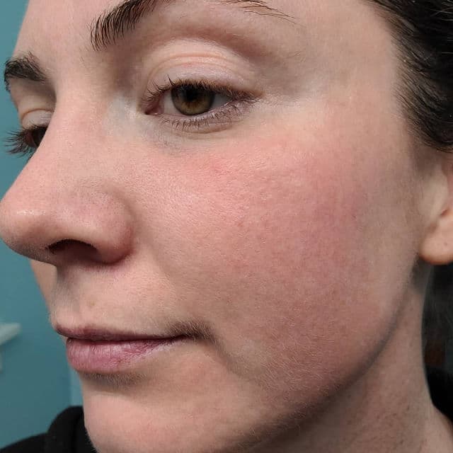 Skinfix Barrier+ Triple Lipid-Peptide Cream review photo by Eudora