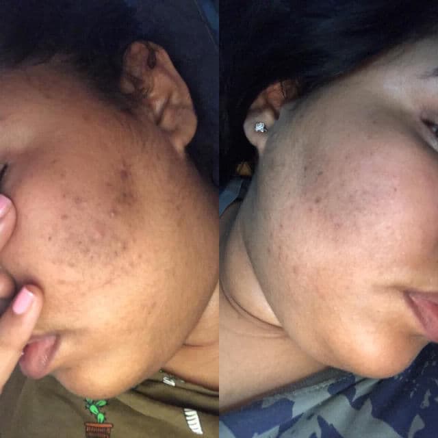 Topicals Faded review photo by Dailysamer 