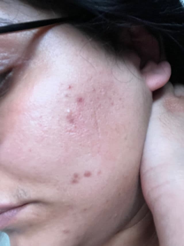 Nip + Fab Salicylic Fix Serum Extreme 2% review photo by SumanBhatti