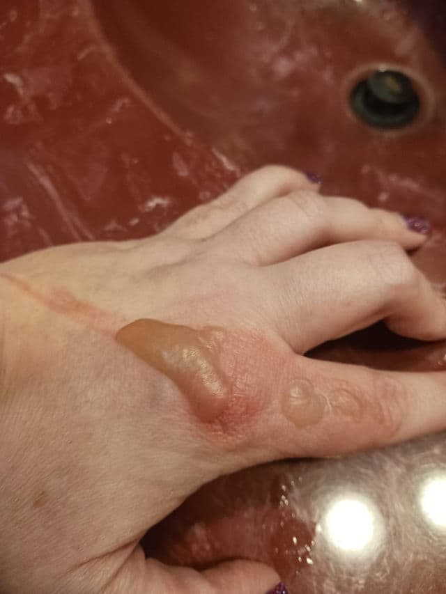 derma e Scar Cream Sun Protectant SPF 35 review photo by rcreddragon