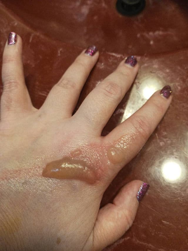 derma e Scar Cream Sun Protectant SPF 35 review photo by rcreddragon