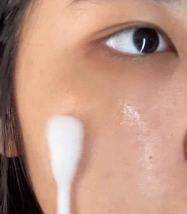 DR. ORACLE 21;Stay A-Thera Tea Tree Peeling Sticks review photo by Skinmekay