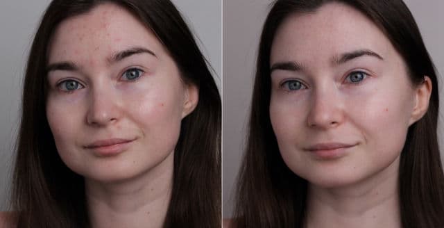 manyo Galactomy Clearskin AHA/BHA Toner review photo by Beautynast 