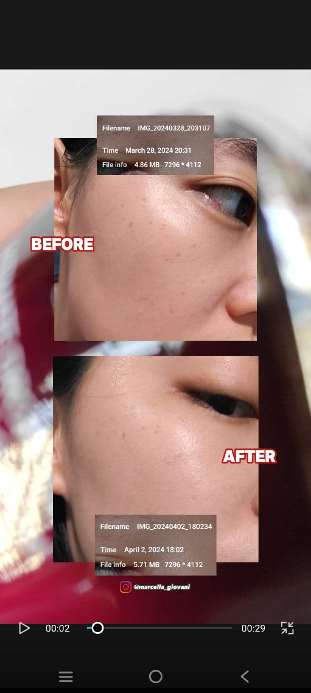 TRUEVE Niacinamide 10% & Ceramide Brightening Serum review photo by cellareviews