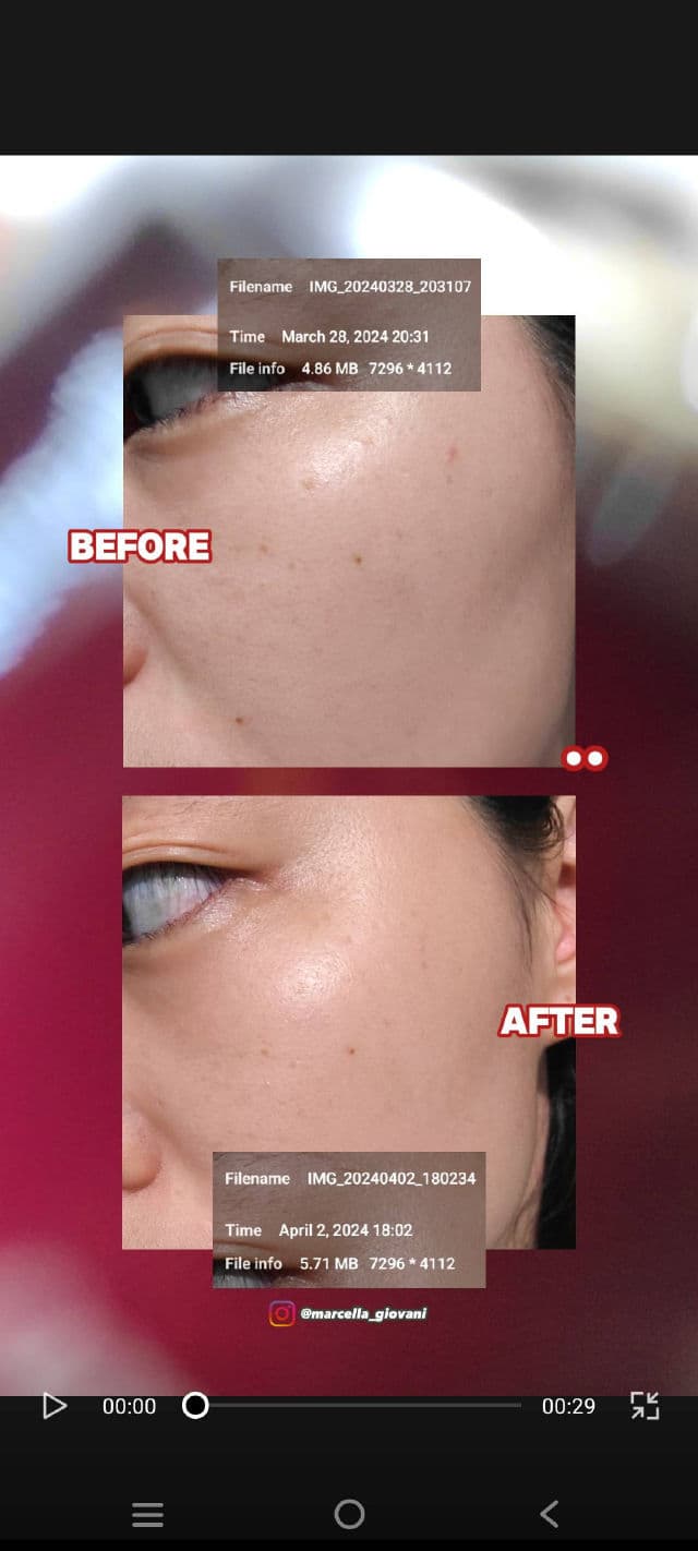 TRUEVE Niacinamide 10% & Ceramide Brightening Serum review photo by cellareviews