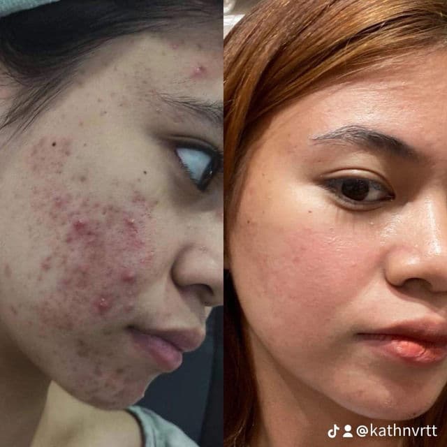 SKIN1004 Madagascar Centella Light Cleansing Oil review photo by crine