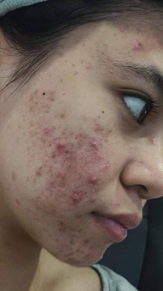 SKIN1004 Madagascar Centella Ampoule Foam review photo by crine