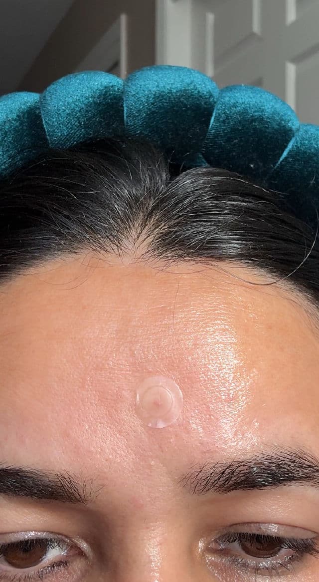 Franz Blemish Care Naked Spot Patch review photo by jassii