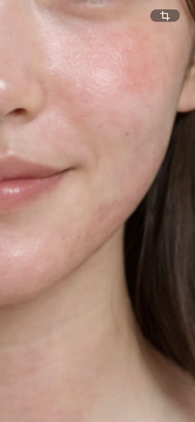 SKIN1004 Madagascar Centella Teca Soothing Toner review photo by ZUHU