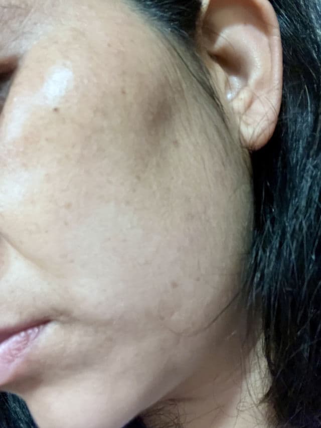 Neutrogena Stubborn Marks PM Treatment with Retinol SA review photo by SandraLuz