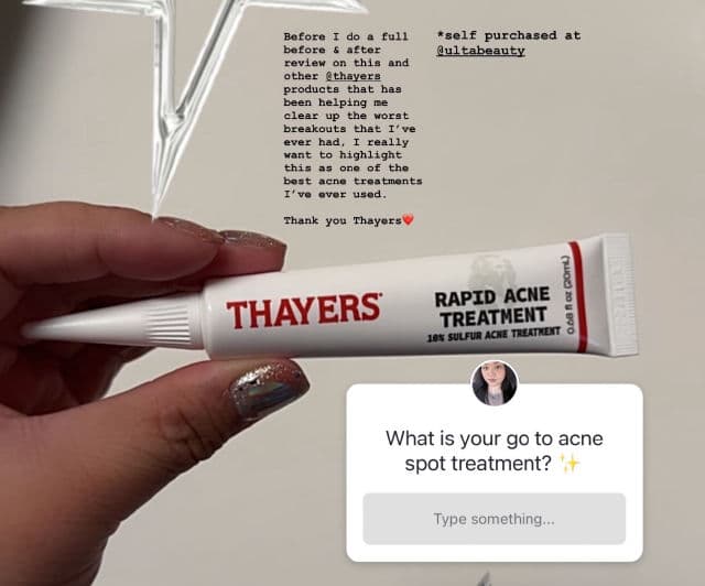 Thayers Rapid Acne Spot Treatment with Niacinamide & 10% Sulfur review photo by BeautyWithAra
