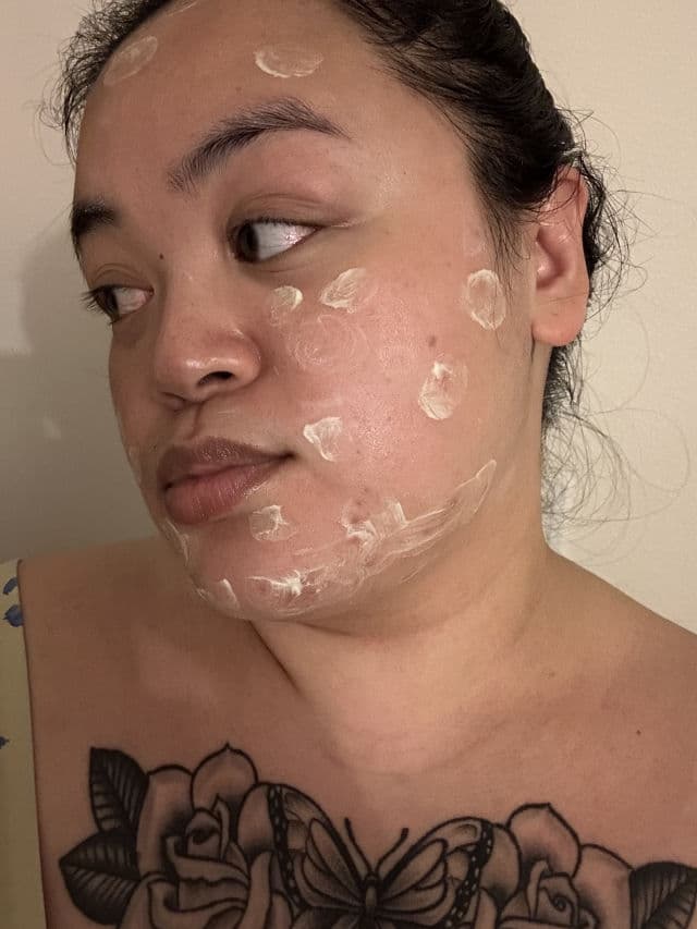 Thayers Rapid Acne Spot Treatment with Niacinamide & 10% Sulfur review photo by BeautyWithAra