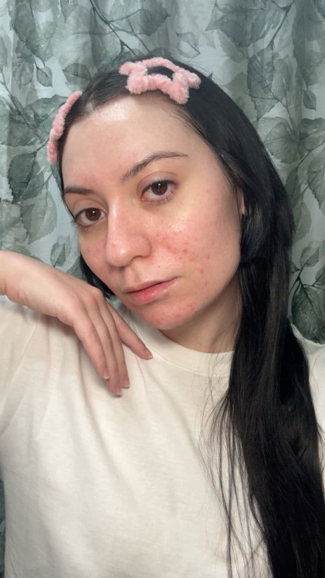 MIXSOON Bifida Mask Sheet review photo by M00NSTIE